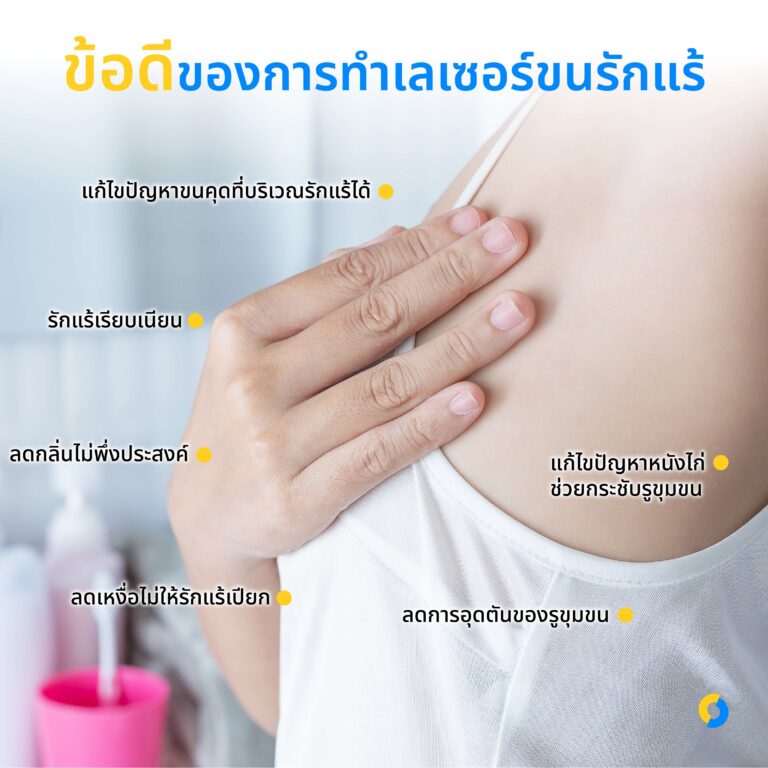 ข้อดีของการทำเลเซอร์ขนรักแร้