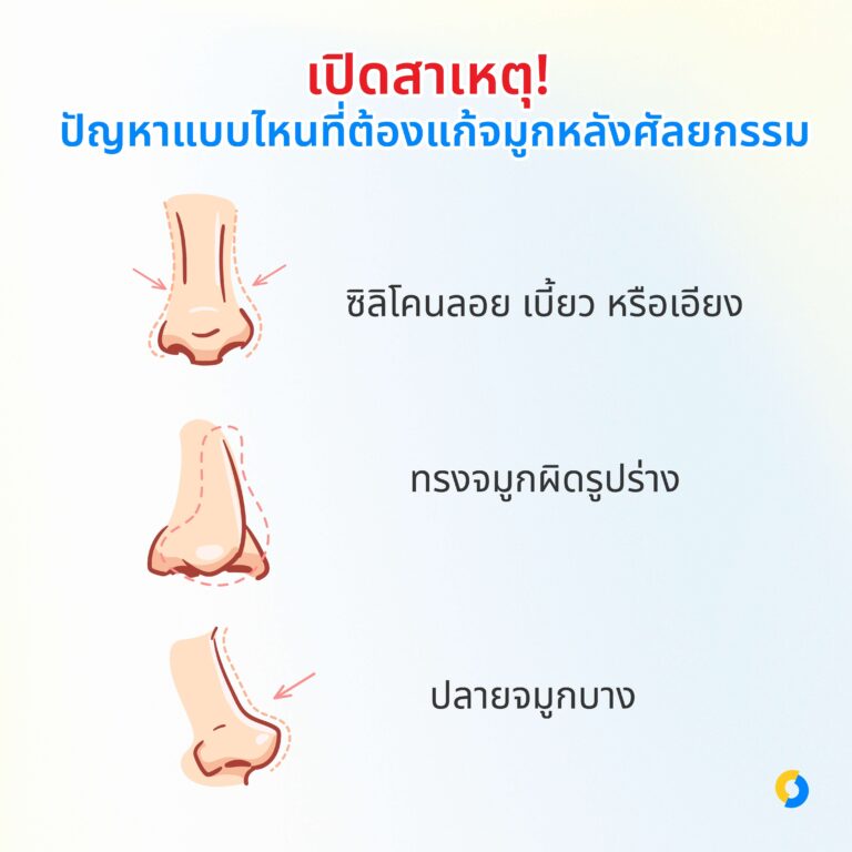 เปิดสาเหตุ! ปัญหาแบบไหนที่ต้องแก้จมูกหลังศัลยกรรม