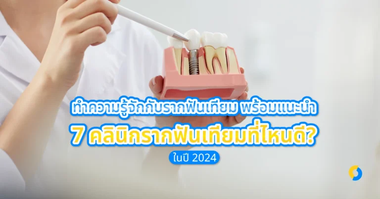 ทำความรู้จักกับรากฟันเทียม พร้อมแนะนำ 7 คลินิกรากฟันเทียมที่ไหนดี? ในปี 2024