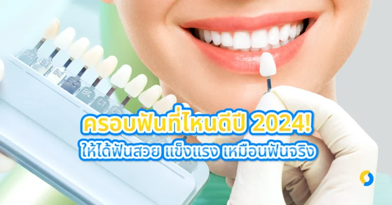ครอบฟันที่ไหนดีปี 2024! ให้ได้ฟันสวย แข็งแรง เหมือนฟันจริง